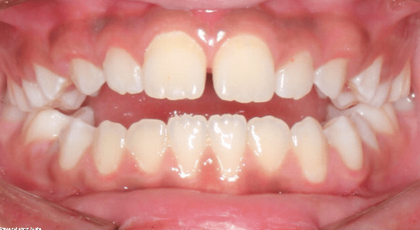 before & afters